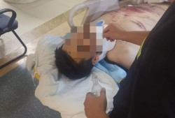 女子被咬身亡事件，家属回应与尸检争议